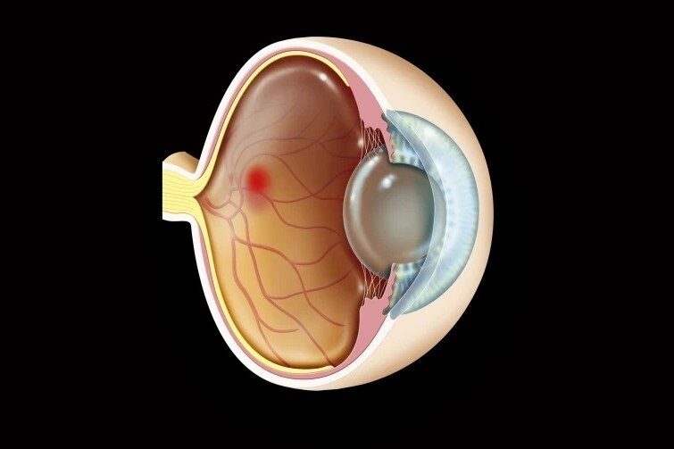 retina in eye advanced eye specialists